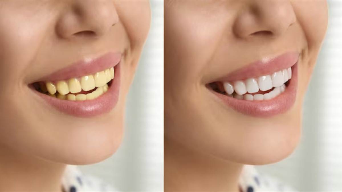 even people who brush their teeth every day turn yellow give up these bad habits today