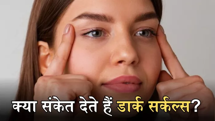 इन कारणों से भी हो सकते हैं आंखों के नीचे काले घेरे