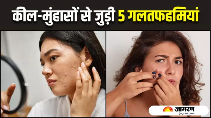Acne Myths: सफेद झूठ हैं कील-मुहांसों से जुड़े 5 मिथक (Image Source: Freepik)
