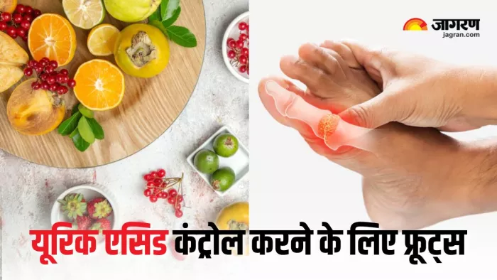 Uric Acid Diet Tips: यूरिक एसिड कम करने में मदद करेंगे ये फ्रूट्स (Picture Courtesy: Freepik)