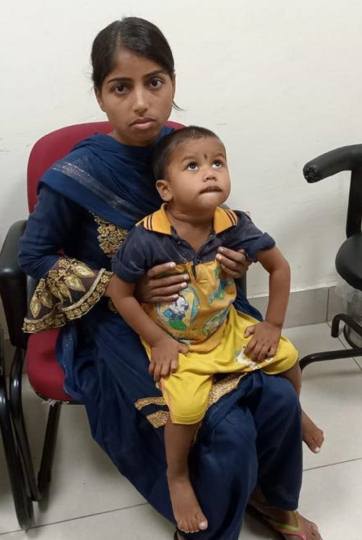 चिकित्सकों ने 21 माह के बच्चे के गुर्दे से निकाली पथरी