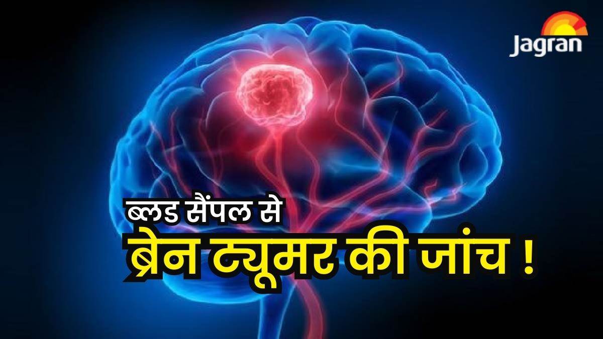 https://www.jagranimages.com/images/newimg/21052023/21_05_2023-blood_sample_23419194.jpg