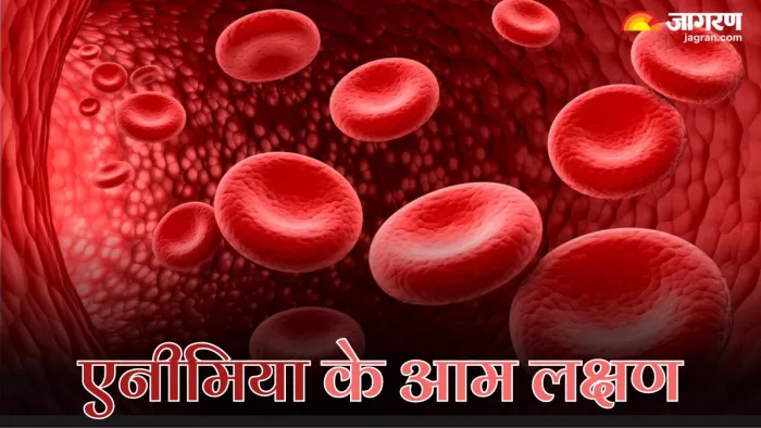 एनीमिया होने पर शरीर में नजर आते हैं ये लक्षण (Picture Credit- Freepik)