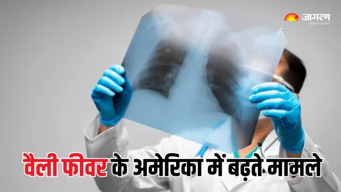 Valley Fever in USA: वैली फीवर के लक्षण कैसे होते हैं? (Picture Courtesy: Freepik)