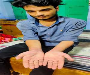 थर्ड डिग्री का शिकार चांदी कारोबारी यश वर्मा।