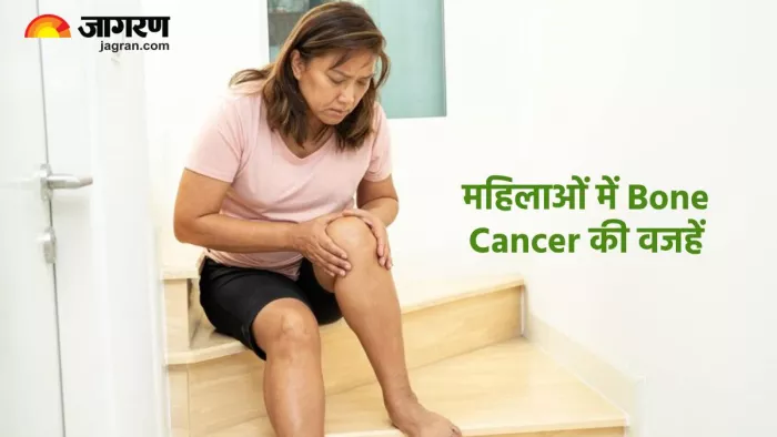महिलाओं में बोन कैंसर की वजहें (Pic credit- freepik)