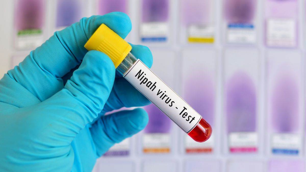 https://www.jagranimages.com/images/newimg/21072024/21_07_2024-niaph-virus-1721488239855_23762467.jpg