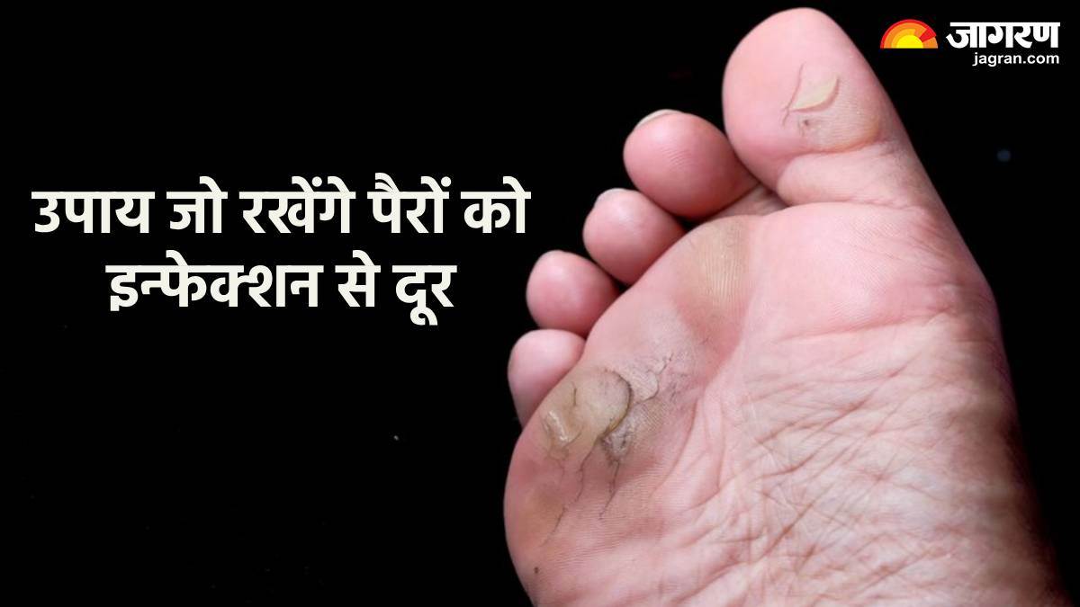 https://www.jagranimages.com/images/newimg/21082024/21_08_2024-prevention_tips_for_foot_infection_23781701.jpg