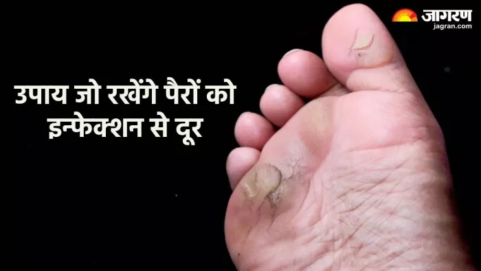 पैरों को इन्फेक्शन से बचाने के टिप्स (Pic credit- freepik)