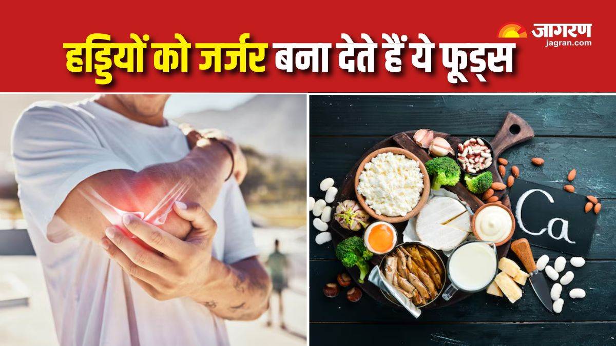 https://www.jagranimages.com/images/newimg/21082025/21_08_2025-foods_to_avoid_for_bone_health_24019852.jpg