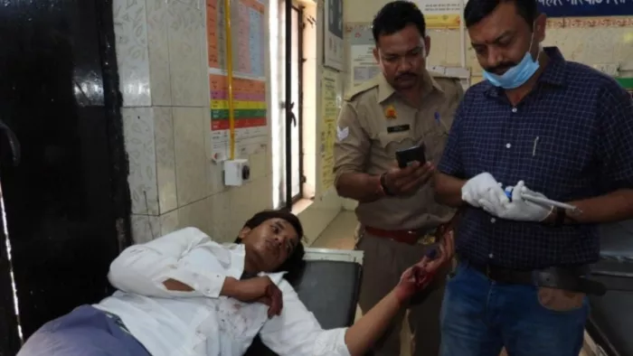 कासिम के हाथ की फोरेंसिक जांच करतीटीम
