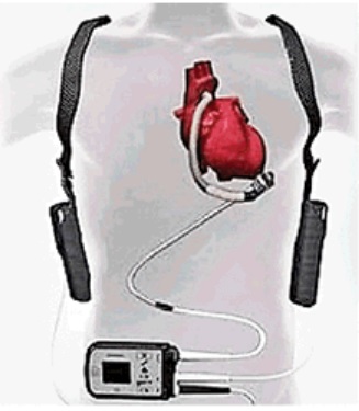 https://www.jagranimages.com/images/newimg/21112023/21_11_2023-heart_23585436.jpg