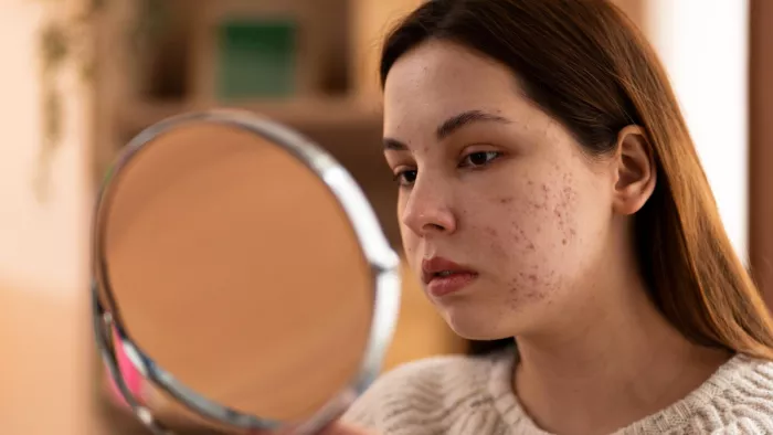 Skin Care: इन तरीकों से पाएं चेहरे के दाग-धब्बों से छुटकारा