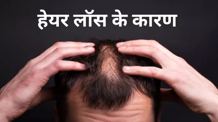 जानें किन वजहों से झड़ने लगते हैं बाल