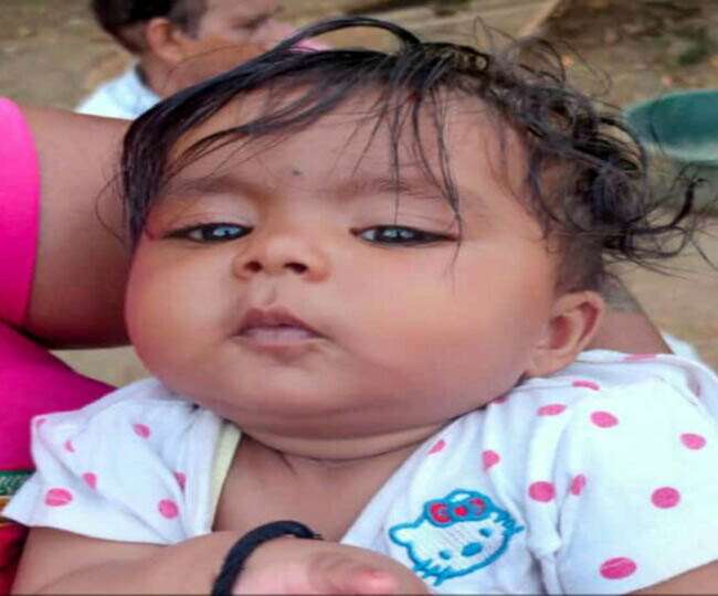 पलामू की 14 माह की सृष्टि रानी। जागरण