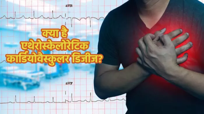 एथेरोस्क्लोरोटिक हृदय रोग के कारण, जोखिम व बचाव के जरूरी उपाय