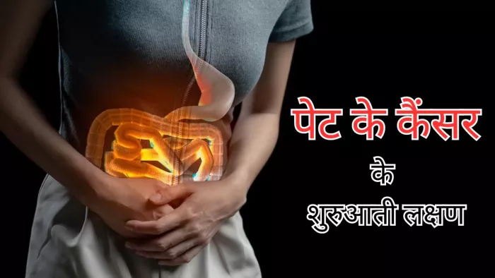 इन शुरुआती लक्षणों से करें पेट के कैंसर की पहचान