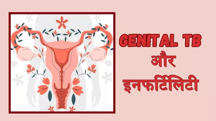 जेनिटल टीबी बन सकता है महिलाओं में इनफर्टिलिटी की वजह