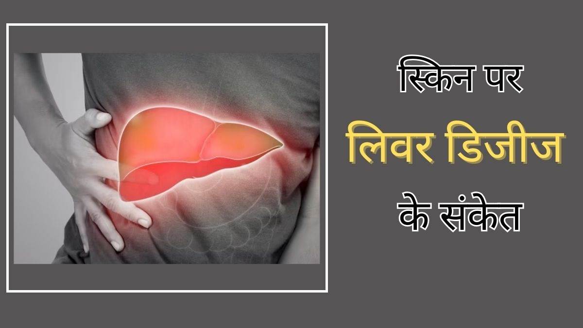 https://www.jagranimages.com/images/newimg/22032024/22_03_2024-liver-disease-signs_23680673.jpg