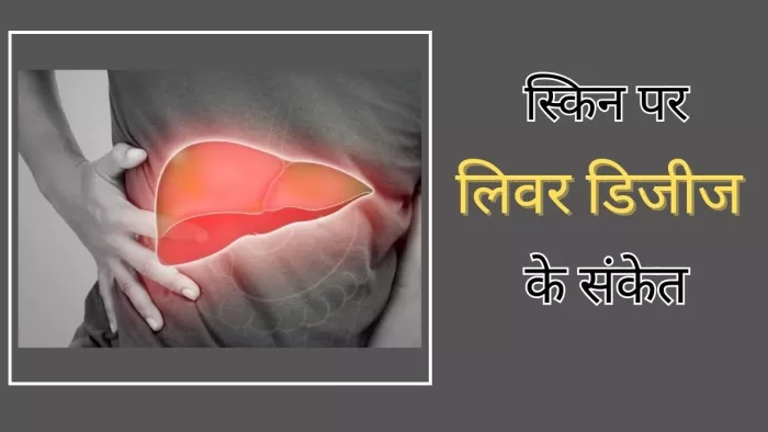 कोहनी और गर्दन की स्किन हो रही है डार्क तो ये हो सकती है वजह
