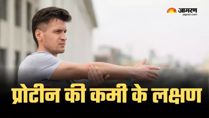 शरीर में प्रोटीन की कमी बताते हैं ये लक्षण। (Image credit- freepik)
