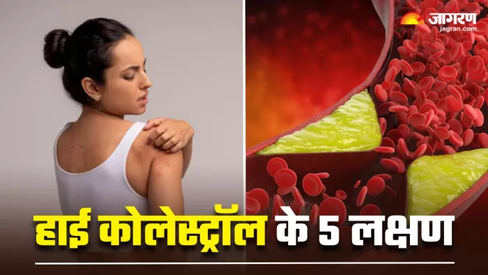 त्वचा पर दिखाई देने वाले 5 लक्षण बताते हैं, शरीर में बढ़ गया है कोलेस्ट्रॉल का स्तर (Image Source: Freepik)