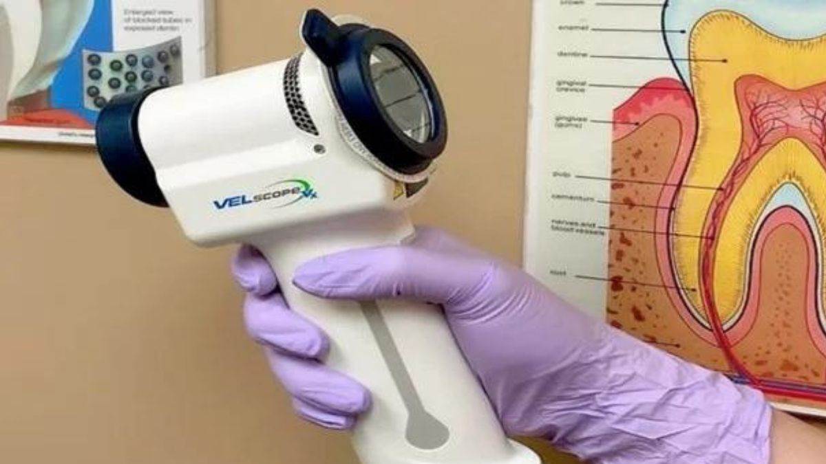 now mouth cancer will be detected early veloscope machine will be started soon in dental college shimla