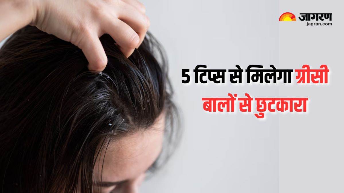 hair easily becomes greasy in summer so keep them fresh and healthy with these 5 tips know details here