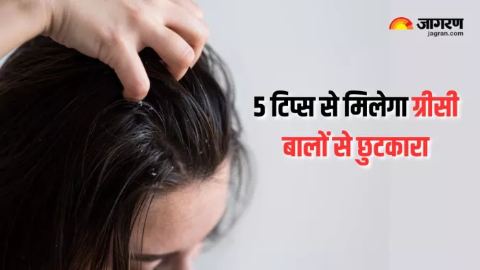बालों की चिपचिपाहट दूर करेंगे ये तरीके (Picture Courtesy: Freepik)