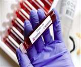 Coronavirus Patna Update: सात और मिले कोरोना पॉजिटिव, सूरत से लौटे युवक निकले संक्रमित