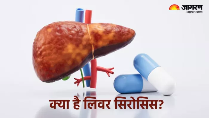 लिवर सिरोसिस के कारण, लक्षण व बचाव (Pic credit- freepik)