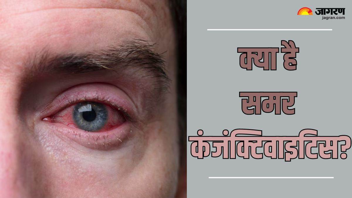 know types causes symptoms and treatment of summer conjunctivitis