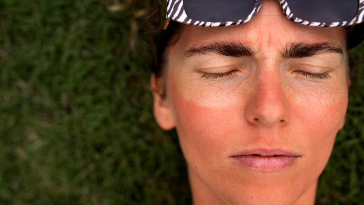https://www.jagranimages.com/images/newimg/22052024/22_05_2024-tanning_3_23722544.jpg