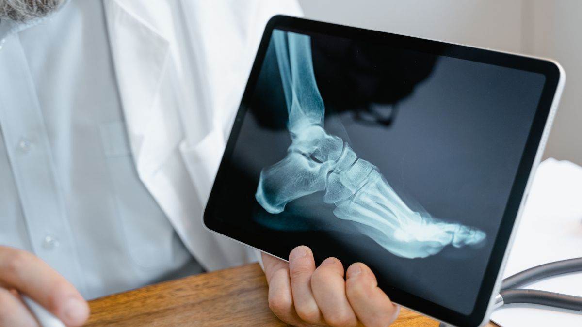 khagaria government hospital condition x ray machine not available for patients