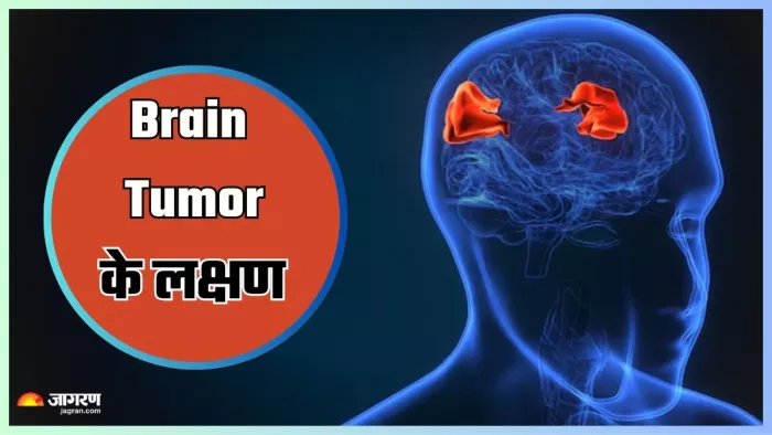 ब्रेन ट्यूमर के लक्षण क्या हैं? (Image Credit- Freepik)