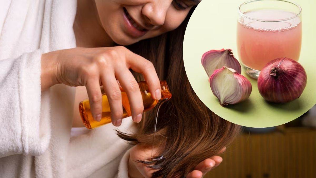 https://www.jagranimages.com/images/newimg/22052025/22_05_2025-onion_juice_for_hair_23944048.jpg