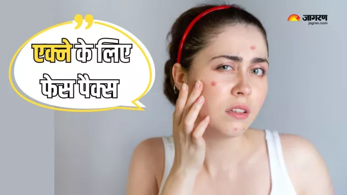 एक्ने से लड़ने के लिए आजमाएं ये नेचुरल फेस पैक्स (Picture Courtesy: Freepik)