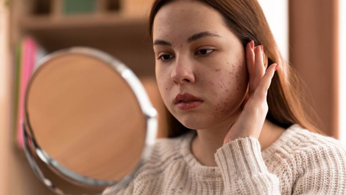 https://www.jagranimages.com/images/newimg/22062024/22_06_2024-skin_problem_23743654.jpg