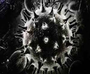 Jamshedpur सदर अस्पताल में मिला ब्लैक फंगस का संदिग्ध मरीज, भेजा गया रांची रिम्स