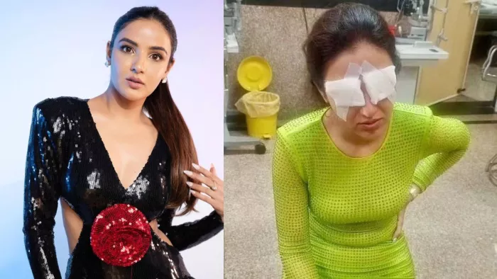 Jasmine Bhasin को Contact Lenses पहनने से हुआ कॉर्नियल डैमेज (Picture Courtesy: Freepik)