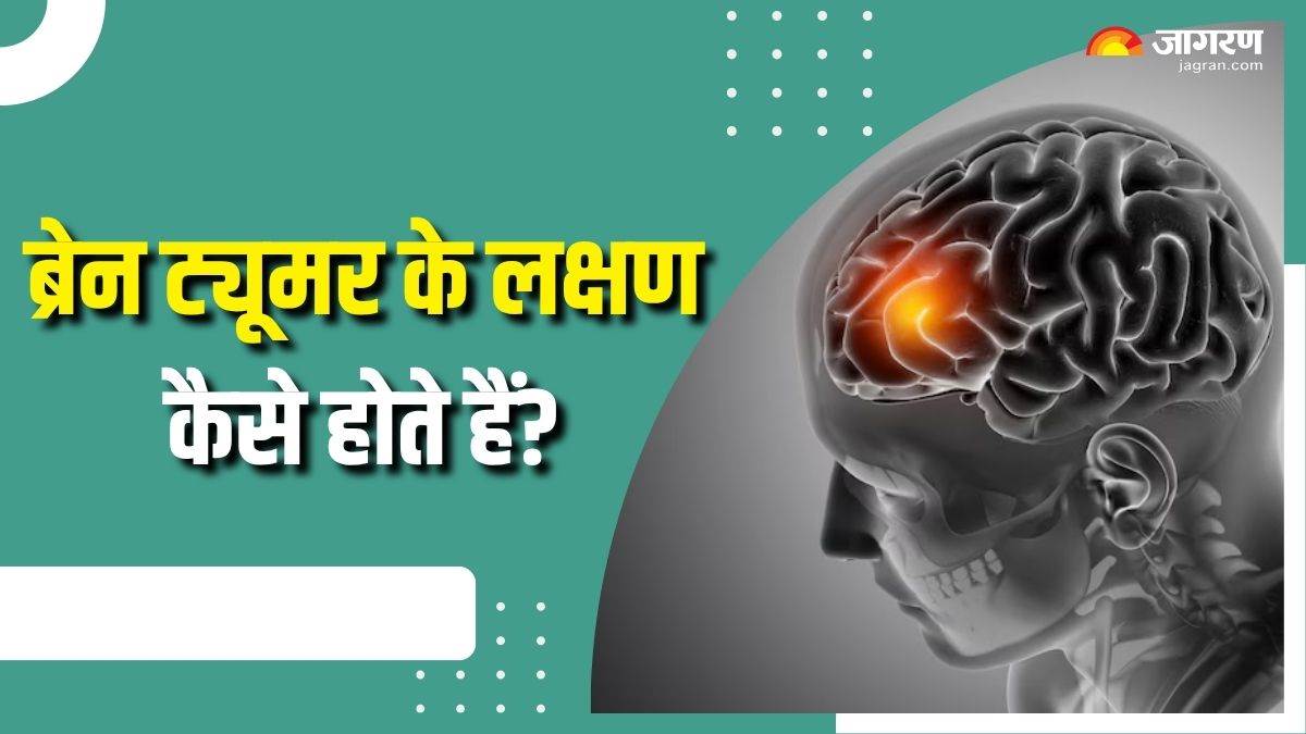 https://www.jagranimages.com/images/newimg/22072025/22_07_2025-brain_tumor_symptoms_23990907.jpg