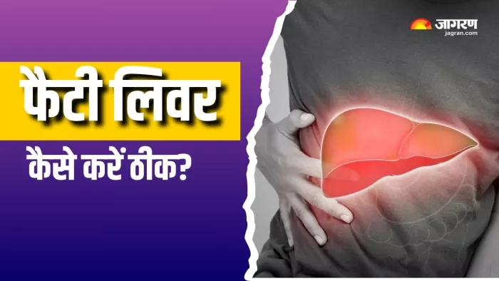 फैटी लिवर से आराम दिलाएंगे ये लाइफस्टाइल चेंजेस (Picture Courtesy: Freepik)