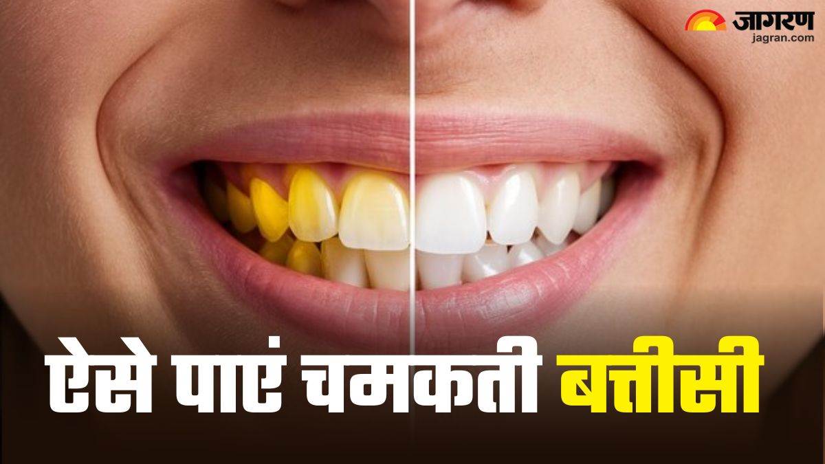 https://www.jagranimages.com/images/newimg/22072025/22_07_2025-yellow_teeth_1_23991283.jpg