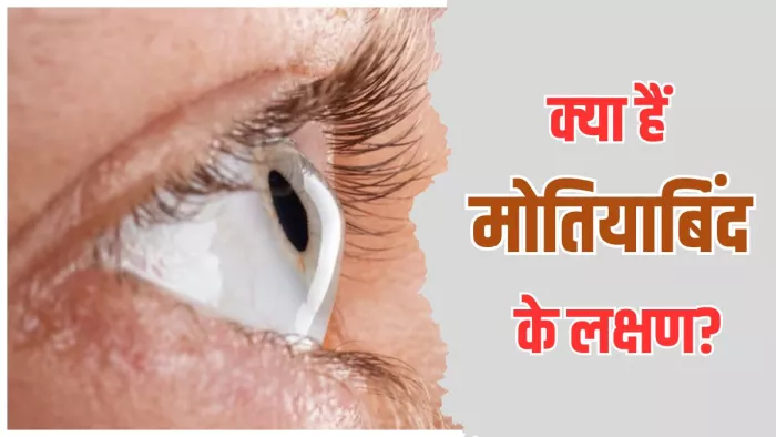 मोतियाबिंद के इन लक्षणों को न करें नजरअंदाज (Image Credit- Freepik)