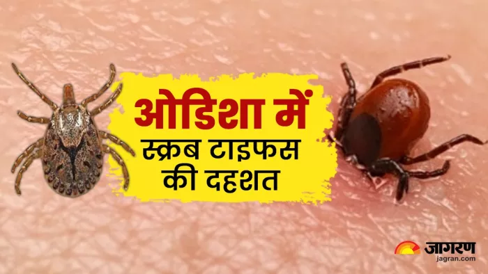 ओडिशा में स्क्रब टाइफस के लगातार आ रहे मामले।