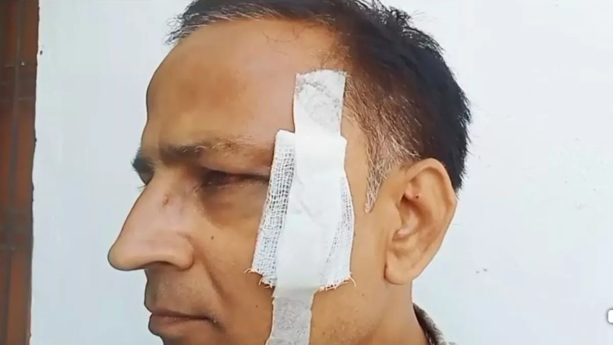 Raibareilly News : रायबरेली में भाजपा मीडिया प्रभारी पर जानलेवा हमला, आंख के पास गंभीर चोट