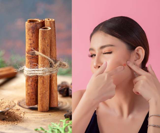 Cinnamon For Skin क्या त्वचा के लिए सच में फायदेमंद होती है दालचीनी