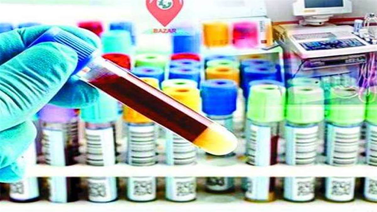 pathology of government hospital in varanasi will now online saving time and getting rid queuing