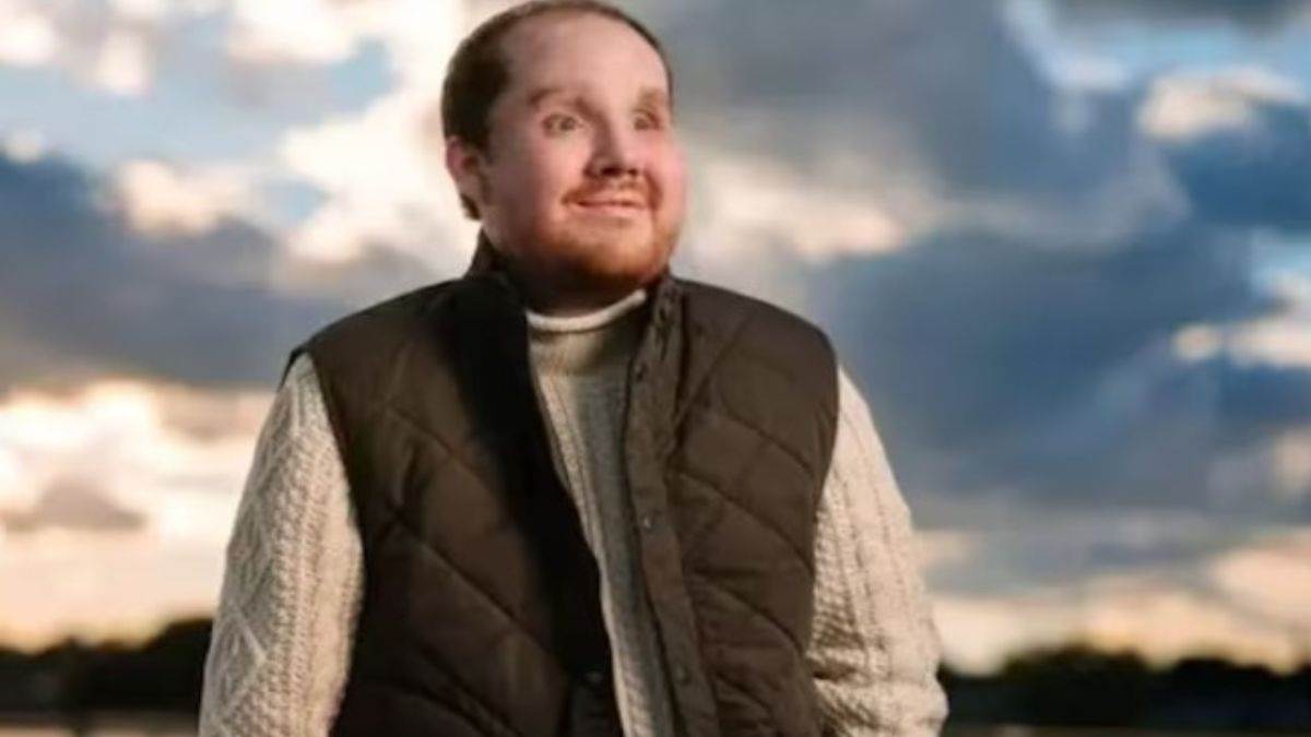 us man derek pfaff receives successful face transplant after suicide attempt