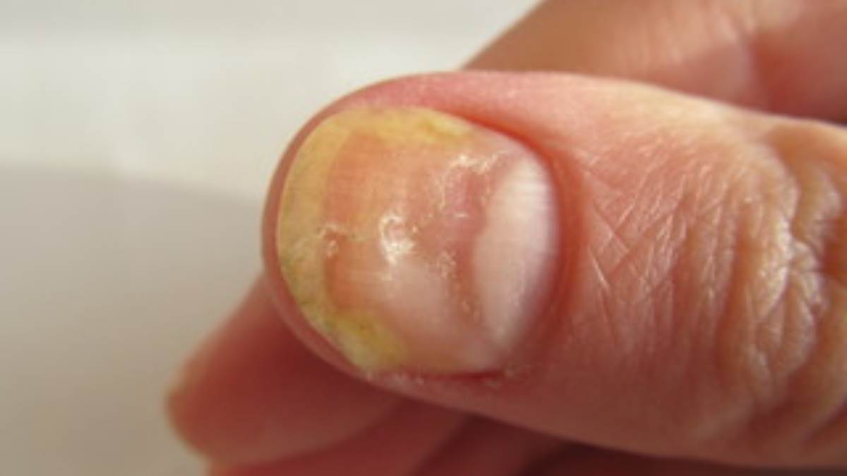 तनाव कम करने से लेकर टैन हटाने तक, इन कारणों से जरूरी है Manicure - nail  care tips and benefits of manicure-mobile
